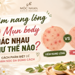 Viêm nang lông và mụn body khác nhau như thế nào? Cách phân biệt để chăm sóc da đúng cách